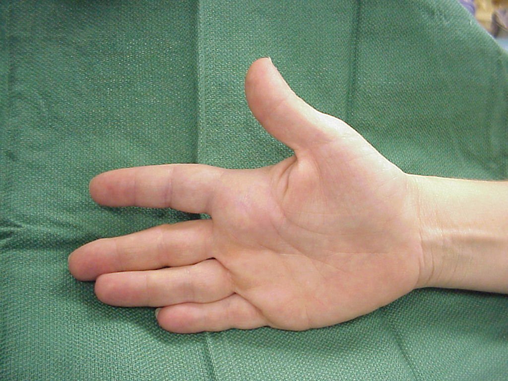 The Best 5 Tendon Gliding Exercises for Hand and Finger Health - bestknock.com - The Best 5 Tendon Gliding Exercises for Hand and Finger Health - bestknock.com