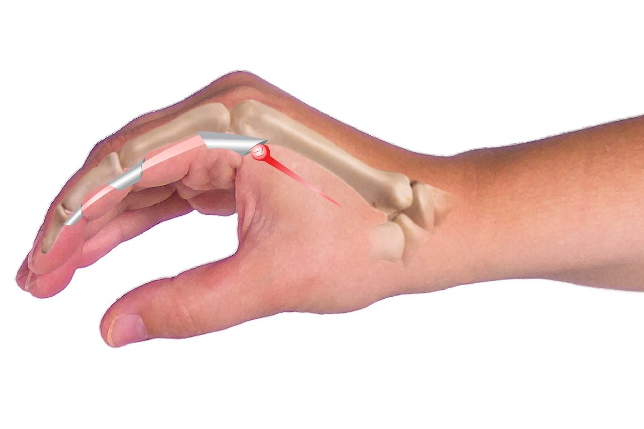 The Best 5 Tendon Gliding Exercises for Hand and Finger Health - bestknock.com - The Best 5 Tendon Gliding Exercises for Hand and Finger Health - Finger Extensor Tendon Glide