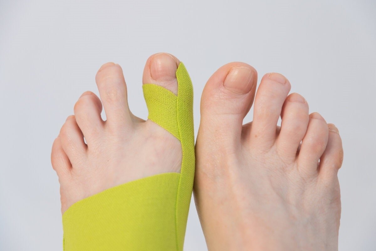 Hallux Rigidus Exercises for Improved Foot Health - bestknock.com