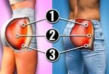 Gluteus Minimus Exercises - bestknock.com