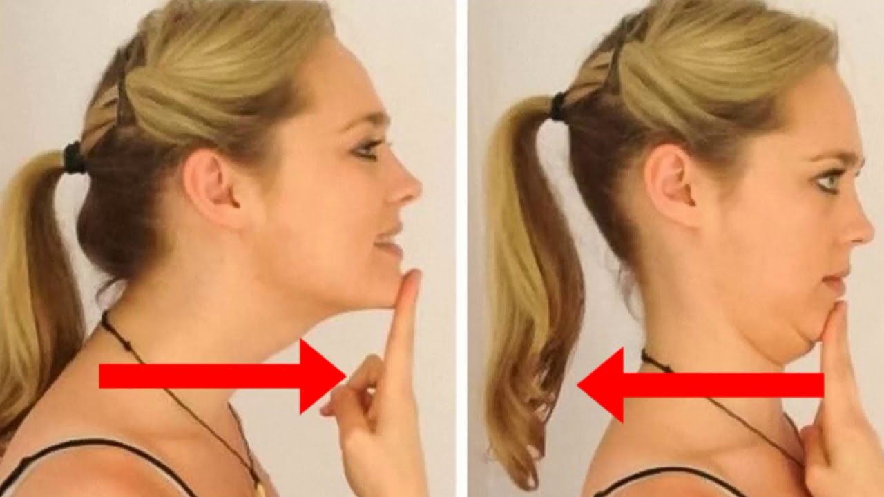 Chin Tuck Exercise - Cervicogenic Headache Exercises - bestknock.com