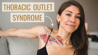 Thoracic Outlet Syndrome Exercises - bestknock.com