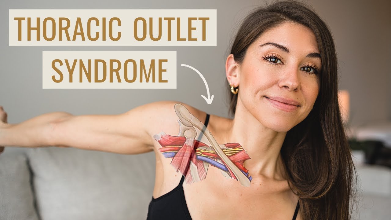 Thoracic Outlet Syndrome Exercises - bestknock.com