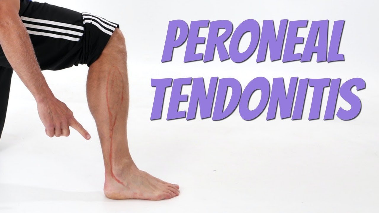 Symptoms of Peroneal Tendonitis